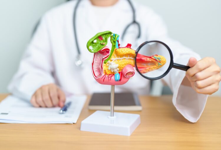 Doctor with human Pancreatitis anatomy model with Pancreas