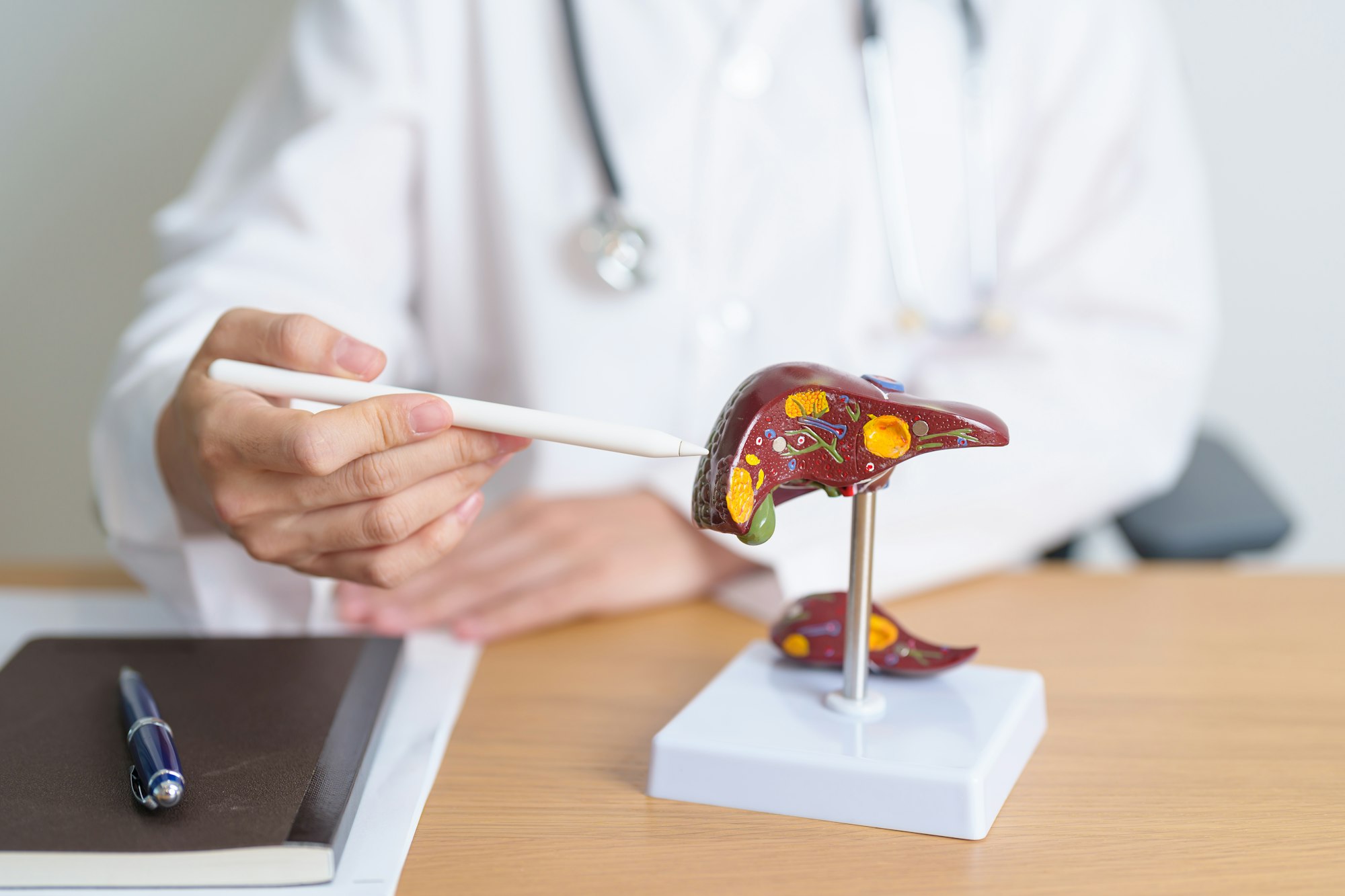 Doctor with human Liver model and tablet. Liver cancer